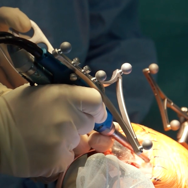 Chirurgie de l'arthrose Lyon